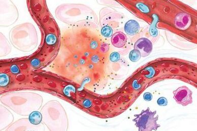 Wirkung von Boswellia auf entzündete Körperstellen