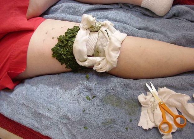 Warme Kompresse aus zerkleinerten Kohlblättern auf einem schmerzenden Kniegelenk mit Arthrose