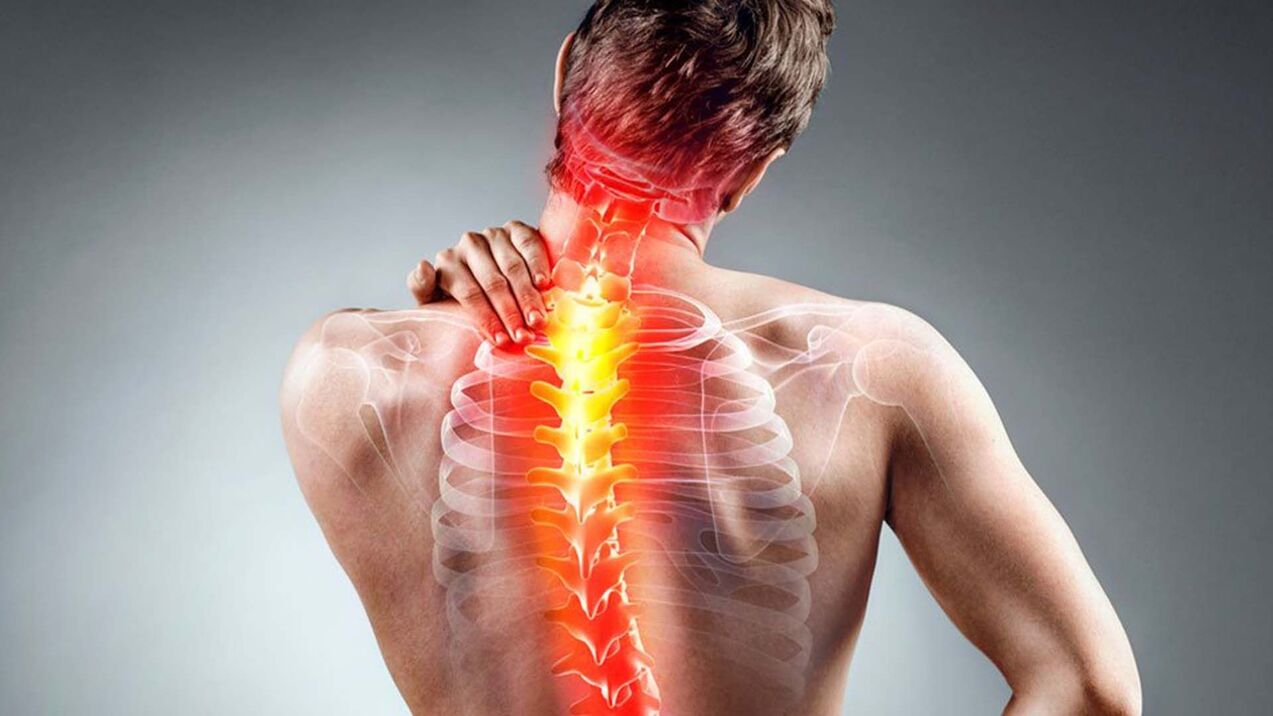 Symptome einer spinalen Osteochondrose